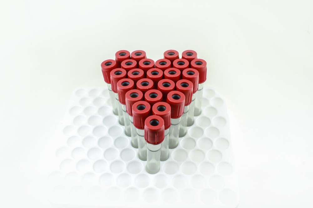 talking Longevity, bloot testing manchester, blood testing london, diagnostics, longevity, treatment plans, wellness, bio-hacking